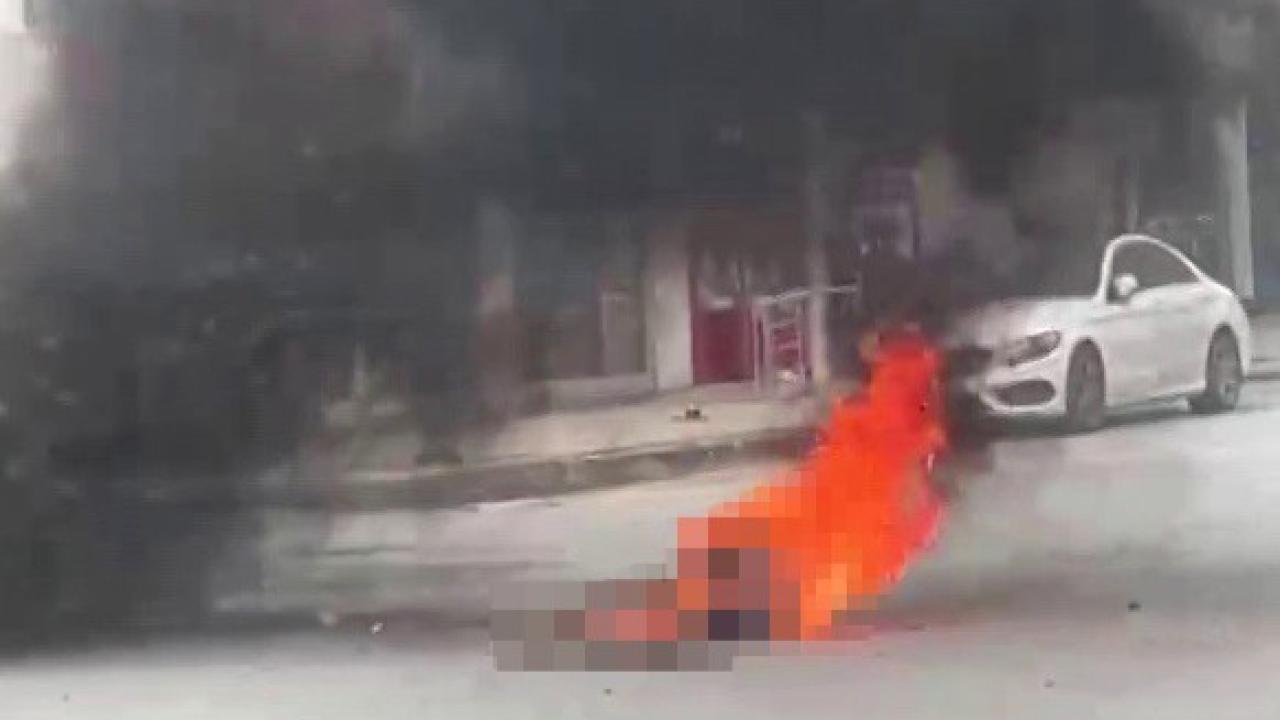 Zihinsel Engelli Şahıs Üzerine Benzin Döküp Kendini Yaktı